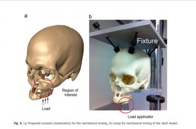a rendering of the testing of a skull model that is 3D printed